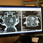 MRI images